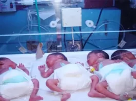 Premature babies